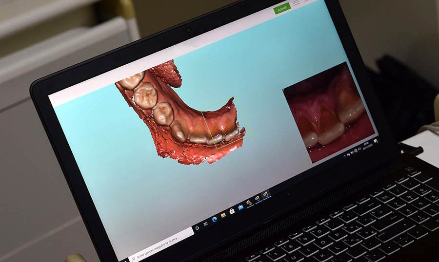 3D-ortodonzia ortodonzia invisibile 3D